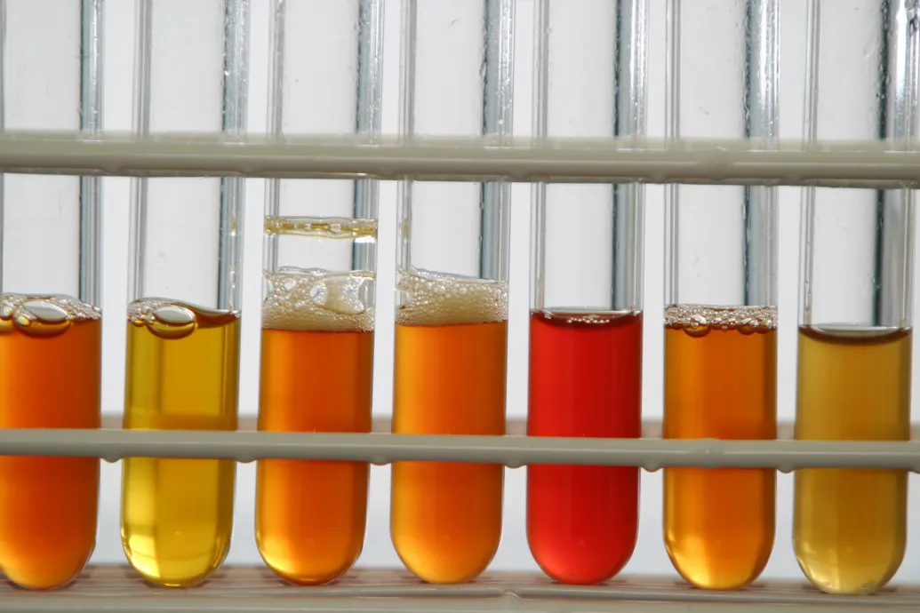 Weight-Loss Drugs Under WADA Scrutiny for Doping List