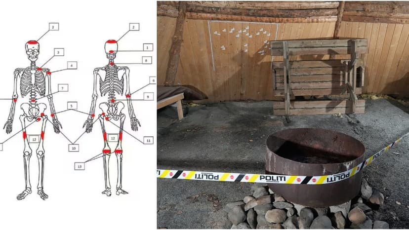 Expert Suggests Dismemberment in Løten Murder Case