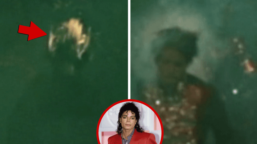 Michael Jackson's Pepsi Commercial Injury Linked to Fatal Addiction