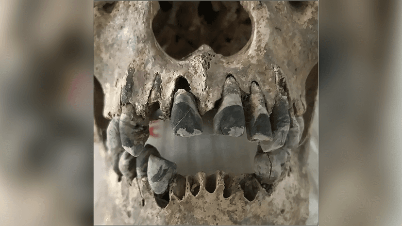 Ancient Vietnamese Practiced Teeth Blackening, Skulls Reveal