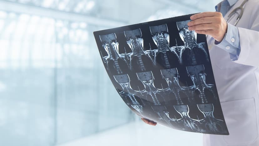 VB Spine to acquire xvision Spine System from Augmedics