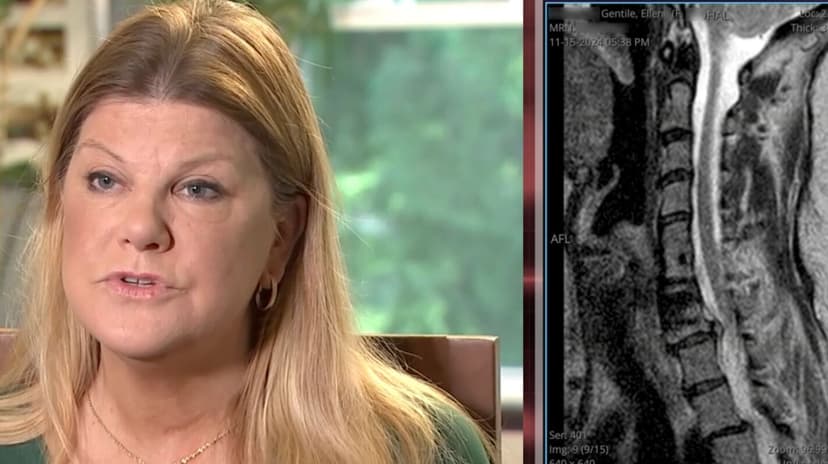 NJ mom was gowned and had an IV in when hospital tried to cancel her surgery. She ended up owing $126K for it