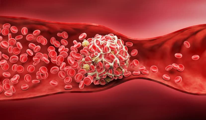 Scientists discover why some COVID-19 vaccines caused blood clots