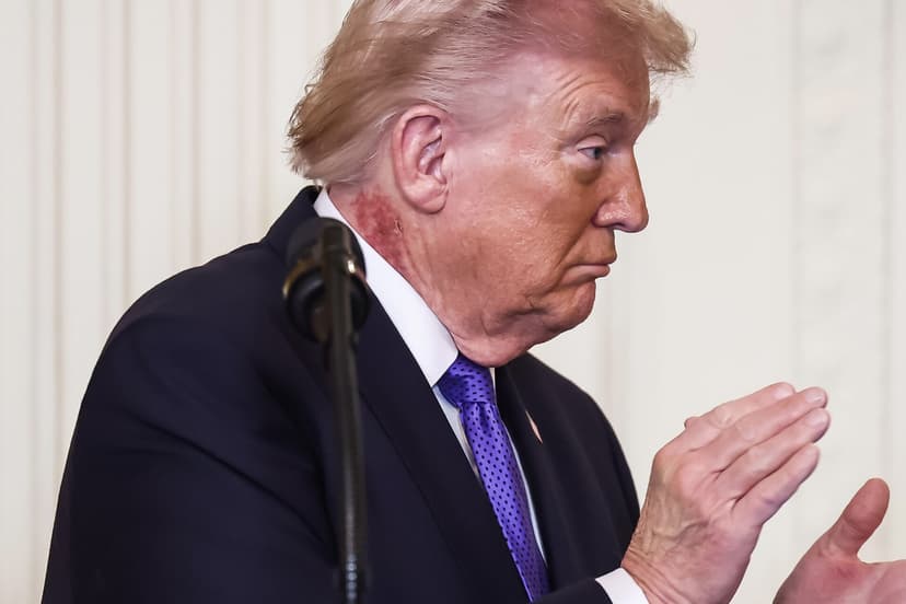 Photo of red mark on Trump's neck spreads, White House responds