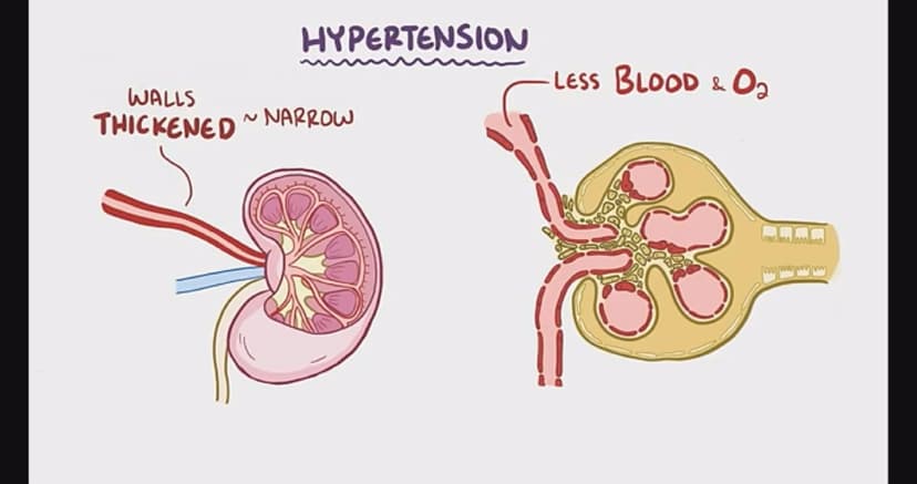 Hypertension rates rising in Ghana as many remain unaware of the condition