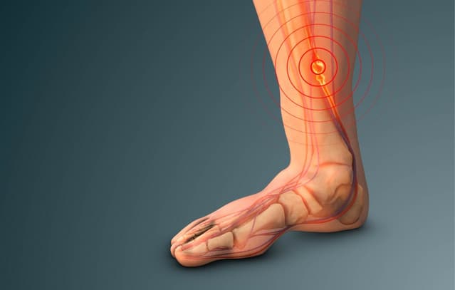 New treatments for thrombosis and varicose veins at the 7th School of the Hellenic Phlebological Society