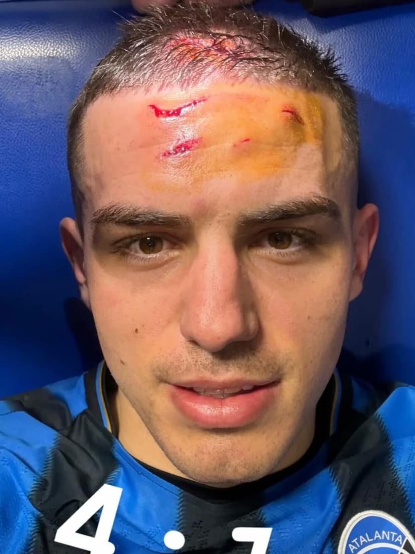 "Heroj" Krstović pokazao rane: Atalanti je trebao centarfor stare...