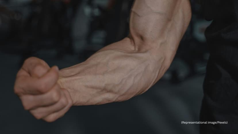 Bulging Veins as a Signal of Underlying Circulation Issues