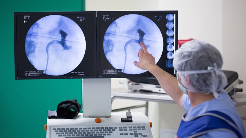 New Research Suggests Bacteria in Kidney Stones