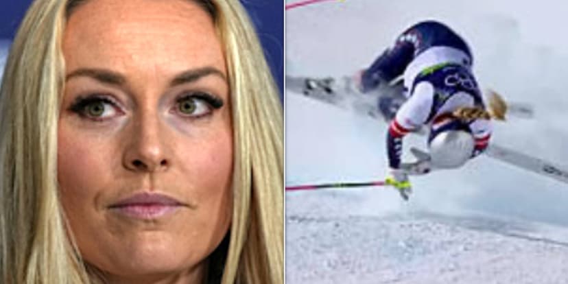 Lindsey Vonn Reveals X-Ray of Complex Leg Fracture