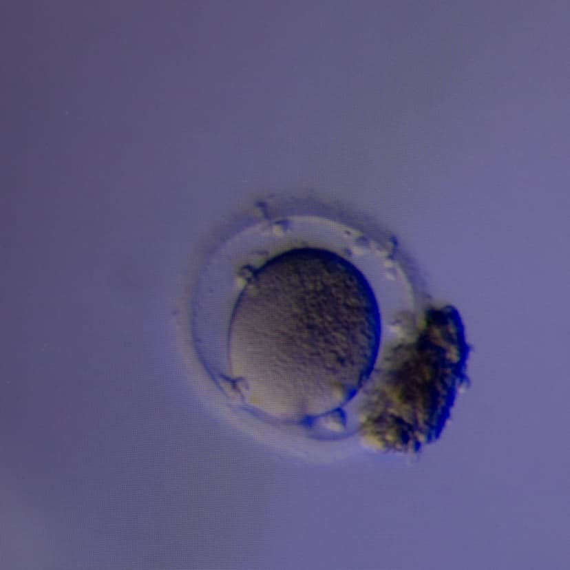 New Method Improves Detection of Eggs for Fertility Treatment