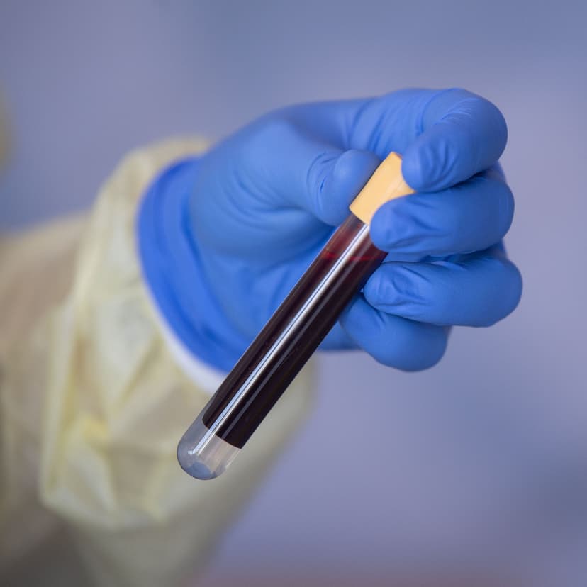 Cancer Detection Test Fails in Major Study