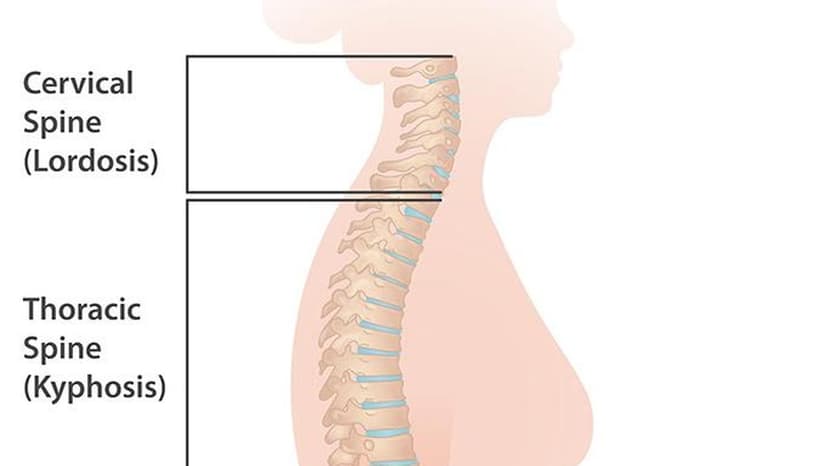 Delaying Spine Surgery Can Lead to Permanent Disability, Experts Warn
