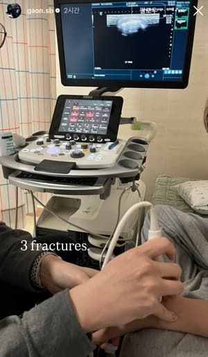 Gold-Winning Snowboarder Choi Ga-on Suffers Three Fractures